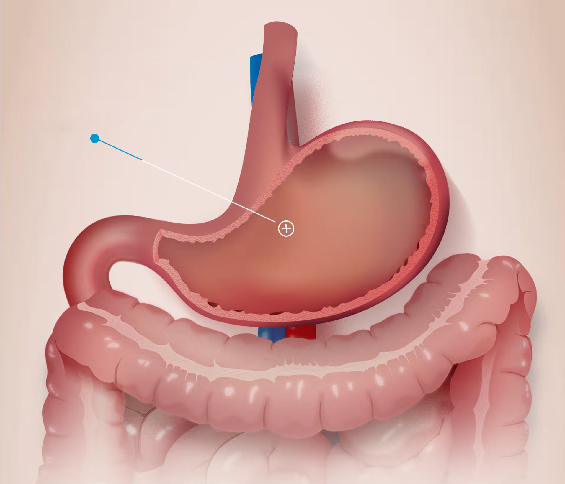 Scientific illustration of the stomach and intestine, with a callout, from the Labialfarma SelfCaps motion video